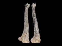 tibia