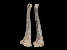 tibia